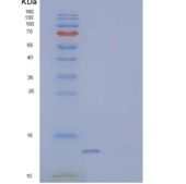 人分泌型跨膜蛋白1重组蛋白