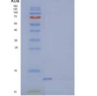 人分泌型跨膜蛋白1重组蛋白