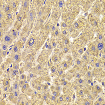 PEX5 Antibody (OAAN01526) in Human Liver using Immunohistochemistry