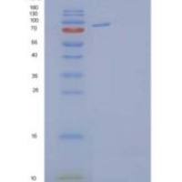 人肝配蛋白A受体4(EPHA4)重组蛋白C-Fc