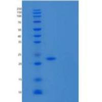 人接粘附分子B/JAM-B/CD322重组蛋白C-6His