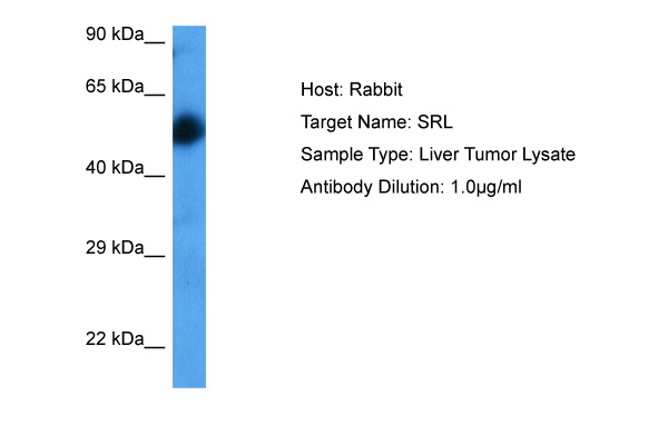 GGTL1 Antibody - C-terminal region (ARP10282_P050) in Human Liver Tumor using Western Blot