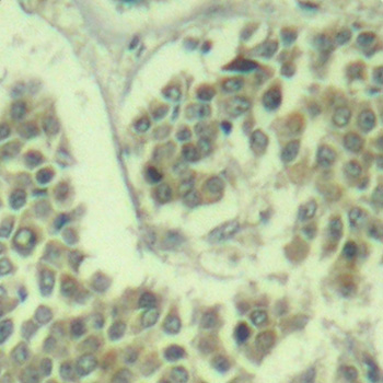 EIF2S1 Antibody (Phospho-Ser49) (OAAN02976) in Human Breast using Immunohistochemistry