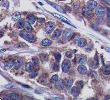 DOK1 Antibody (Phospho-Tyr362) (OAAN02889) in Human Breast using Immunohistochemistry