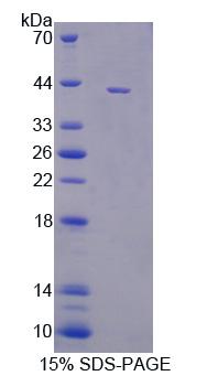 DNM3 Recombinant Protein (OPCD00195) using SDS-PAGE