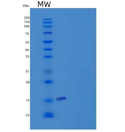 人半胱氨酸蛋白酶抑制剂2(CST2)重组蛋白C-6His