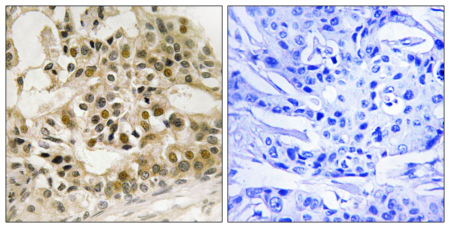 MYB Antibody (Phospho-Ser532) (OAAB20507) in Human Breast Carcinoma Cells using Western Blot
