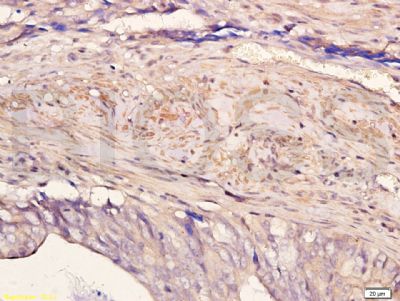 扑克蒙蛋白抗体