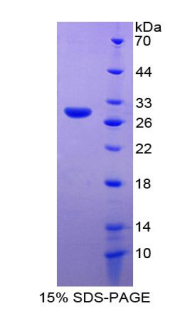 MMP14 Recombinant Protein (OPCD05323) using SDS-PAGE