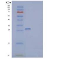 人IL-2受体亚单位γ/IL-2RG/CD132重组蛋白C-Fc-6His