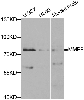 MMP9 Antibody (OAAN00717) in Multiple Cell Lines using Western Blot