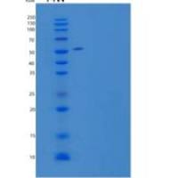 人脂多糖结合重组蛋白