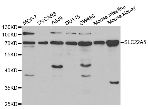 SLC22A5 Antibody (OAAN00467) in Multiple Cell Lines using Western Blot