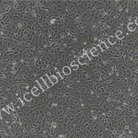 大鼠股骨头微血管内皮细胞/免疫荧光鉴定