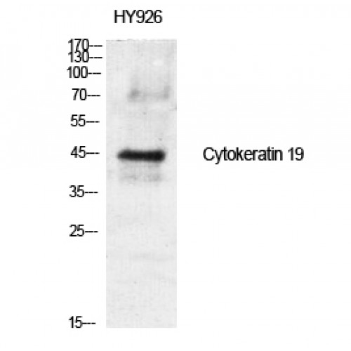 KRT19 Antibody - middle region (OASG02053) in HY926 using Western Blot