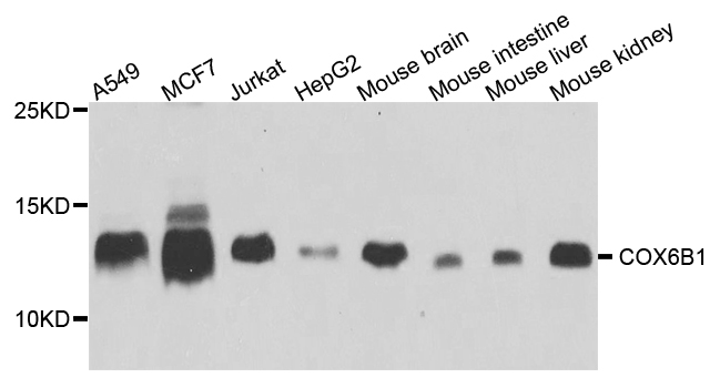 COX6B1 Antibody (OAAN00932) in Multiple Cell Types using Western Blot