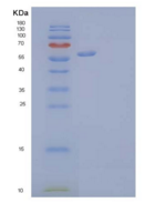 人肝配蛋白A型受体4重组蛋白