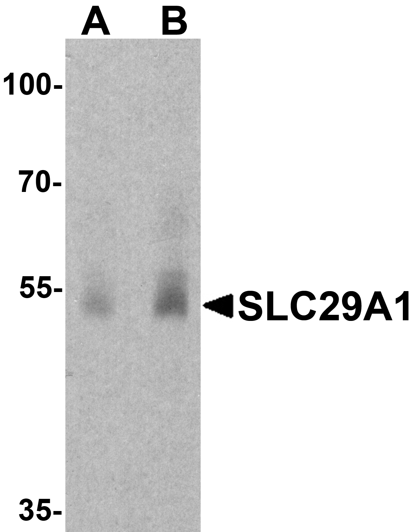 SLC29A1 Antibody - N-terminal (OAPB02003) in Ovary tissue lysate using Western Blot