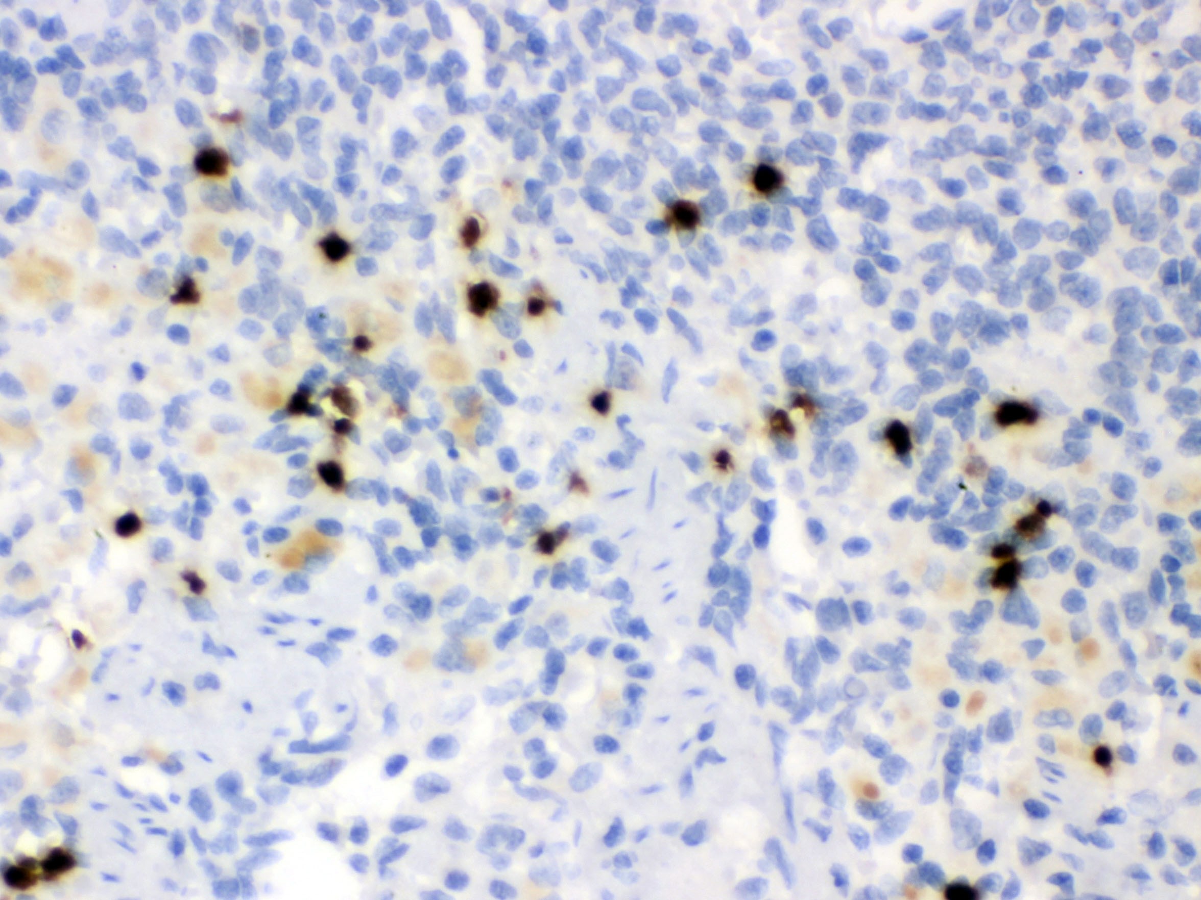 LIPOCALIN 2 Antibody (OABB02091) in Rat Spleen Tissue using Immunohistochemistry