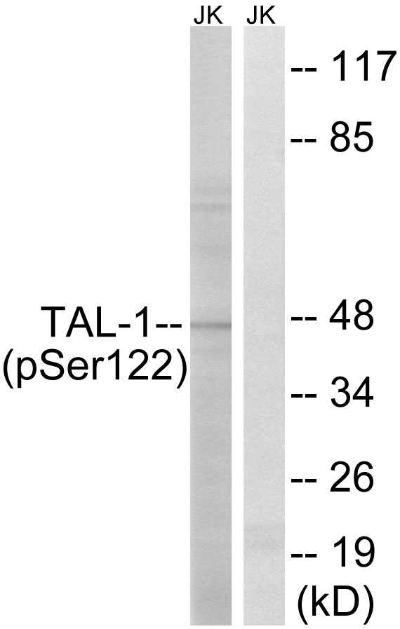 TAL1 Antibody (Phospho-Ser122) (OAAB20730) in Human Jurkat Cells using Western Blot