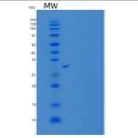 人CRTAMV/CD355重组蛋白C-6His