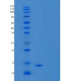 人胱抑素D重组蛋白