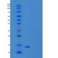 人胱抑素D重组蛋白