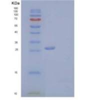 人聚集蛋白-11/胶原11重组蛋白C-6His