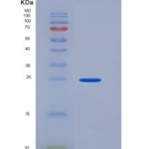 人CD16a / FCGR3A重组蛋白176 Val, His & AVI tag