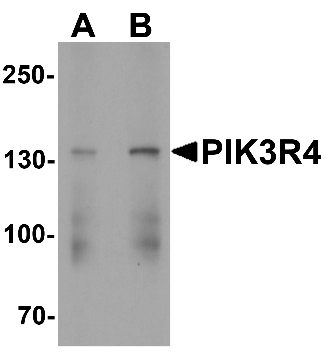 PIK3R4 Antibody - C-terminal (OAPB01946) in Tonsil tissue lysate using Western Blot
