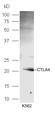 细胞毒性T细胞抗原-4抗体