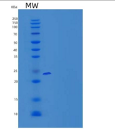 小鼠信号淋巴细胞激活分子家族成员8(SLAMF8)重组蛋白C