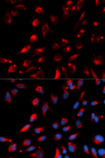CPE Antibody (OAAN01296) in U20S Cells using Immunofluorescence