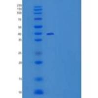 人FGF R5/FGFRL1重组蛋白C-6His