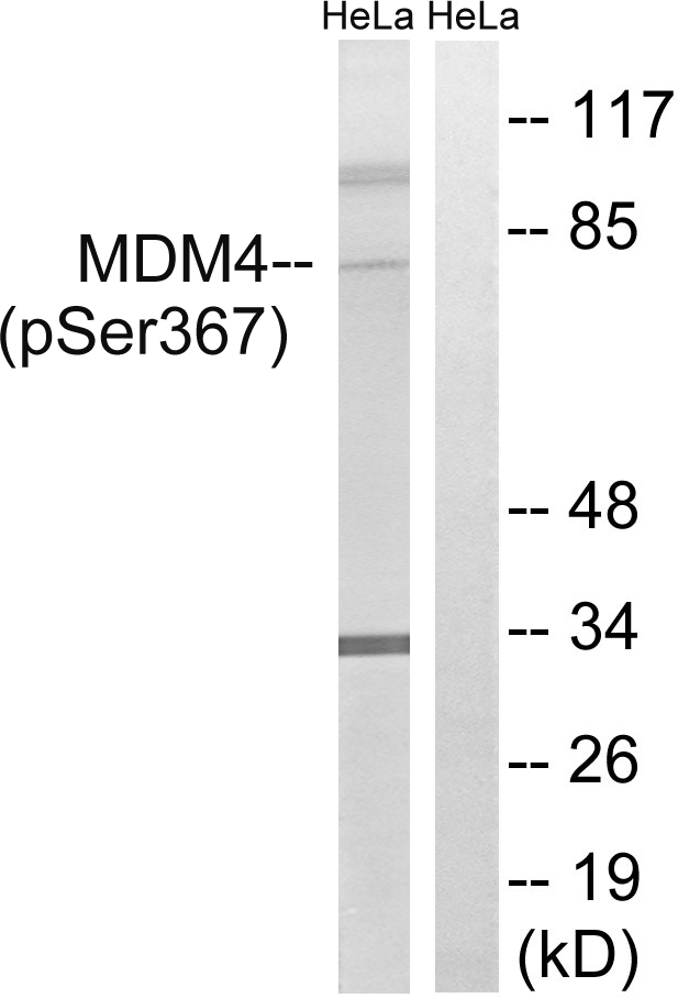 MDM4 Antibody (Phospho-Ser367) (OAAB20479) in Human HeLa Cells using Western Blot