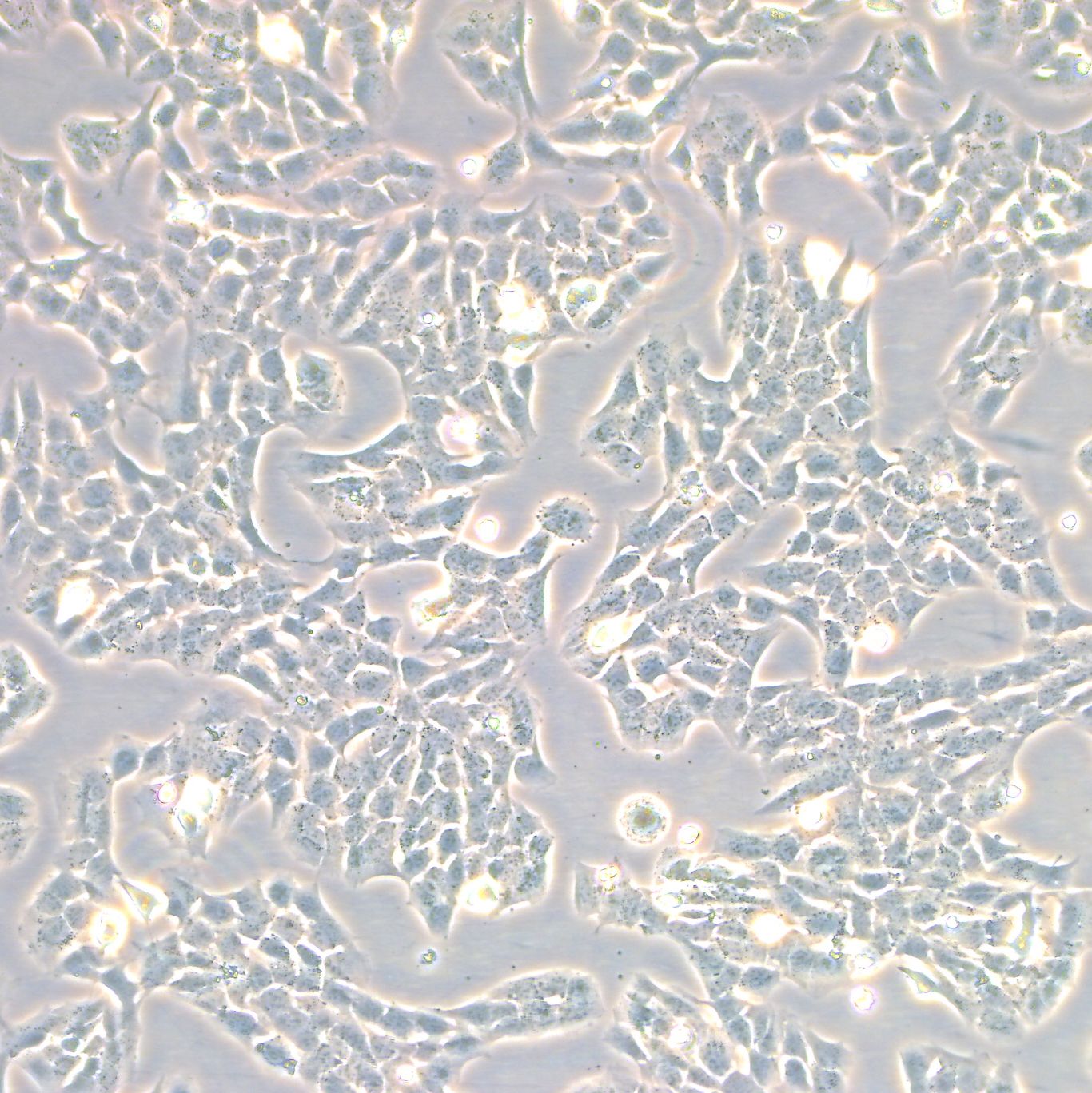 A-673细胞|A-673人横纹肌肉瘤细胞|人横纹肌肉瘤细胞