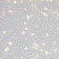 A-673细胞|A-673人横纹肌肉瘤细胞|人横纹肌肉瘤细胞