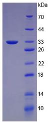 KRT5 Recombinant Protein (OPCD04766) using SDS-PAGE
