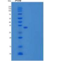 小鼠Basigin 重组蛋白