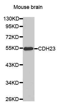 CDH23 Antibody (OAAN00960) in Mouse Brain using Western Blot