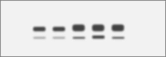 1117128274647317.jpg 条带模糊、不清晰.jpg