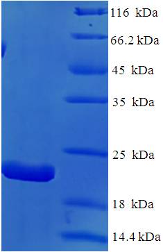 IL18 Recombinant Protein (OPCA02551) in SDS-PAGE Electrophoresis
