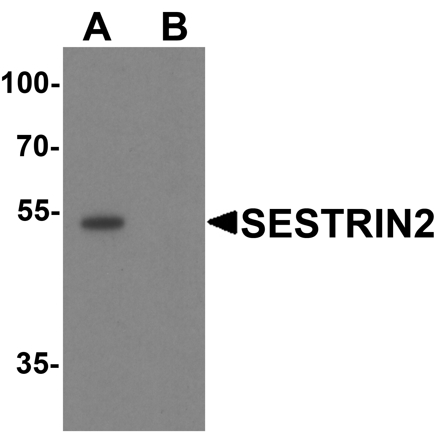 SESTRIN2 Antibody - N-terminal (OAPB01969) in Kidney tissue lysate using Western Blot
