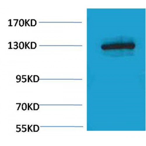 CDH1 Antibody (OASG02298) using Western Blot