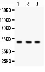 CTBP2 Antibody (OABB01909) in COLO320 Whole Cell Lysate, 293T Whole Cell Lysate, HELA Whole Cell Lysate using Western Blot