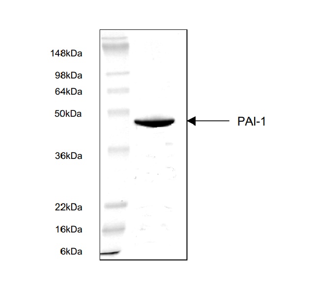 Plasminogen Activator Inhibitor 1 Protein (OPRB00075) in PAI-1 using Western Blot