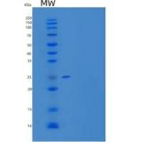 人柯萨奇病毒和腺病毒受体/CAR/CXADR重组蛋白C-6His