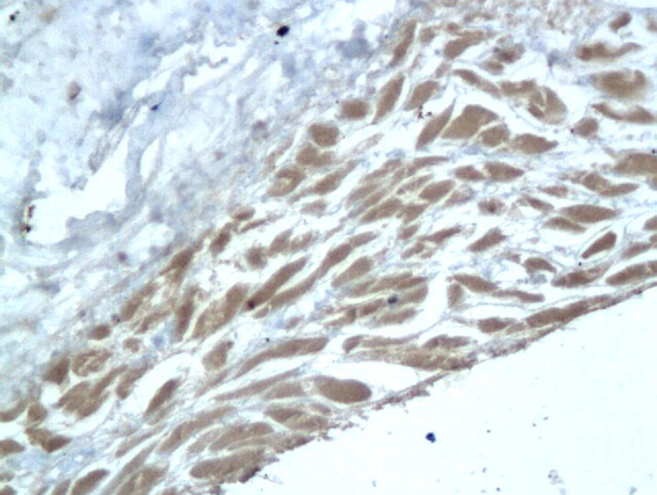 IL9 Antibody (OAAB21862) in Human Rheumatoid Synovial Tissue Cells using Immunohistochemistry
