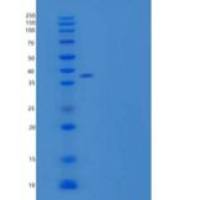 人果糖-1，6-二磷酸酶1/FBP酶1重组蛋白C-6His