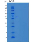 人果糖-1,6-二磷酸酶1/FBP酶1重组蛋白C-6His